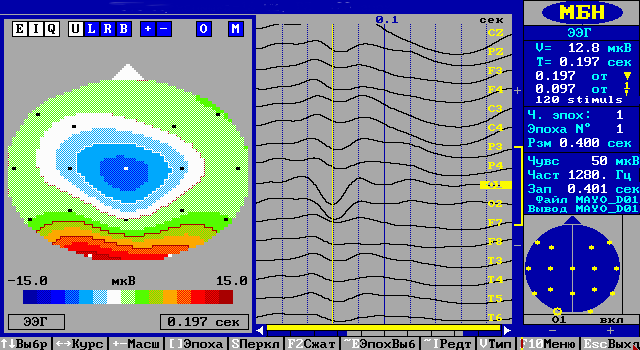 Топографическое картирование