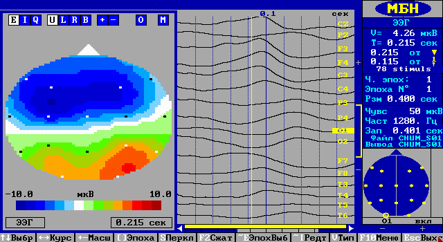 14 лет, пулевое ранение головы с повреждением зрительного нерва правого глаза.