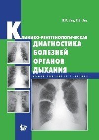 Клинико-рентгенологическая диагностика болезней органов дыхания: общая врачебная практика