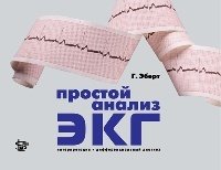 Простой анализ ЭКГ. Интерпретация. Дифференциальный диагноз.