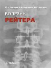 Болезнь Рейтера