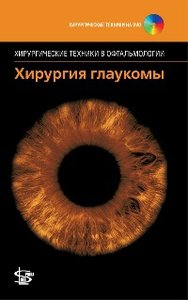 Хирургия глаукомы
