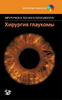 Хирургия глаукомы