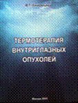 Термотерапия внутриглазных опухолей