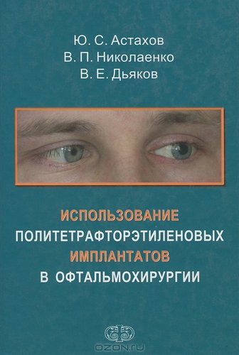 Использование политетрафторэтиленовых имплантатов в офтальмохирургии