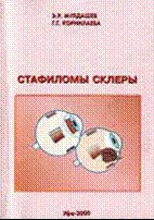 Стафиломы склеры