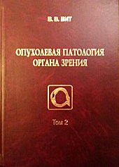 Опухолевая патология органа зрения