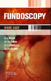 Fundoscopy made easy