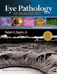 Eye pathology: an atlas and tex