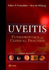 Uveitis 3e