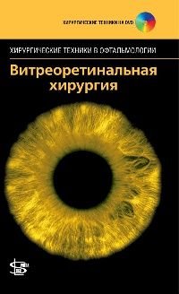 Витреоретинальная хирургия