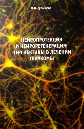 Нейропротекция и нейрорегенерация: перспективы в лечении глаукомы