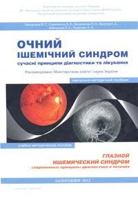Глазной ишемический синдром. Современные принципы диагностики и лечения