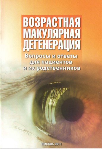 Возрастная макулярная дегенерация. Вопросы и ответы для пациентов и их родственников