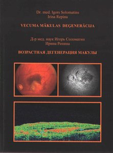 Возрастная  дегенерация макулы