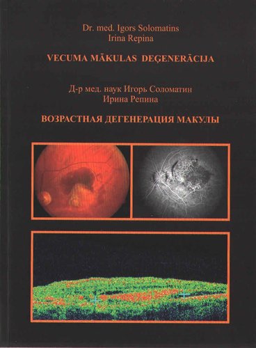 Возрастная  дегенерация макулы