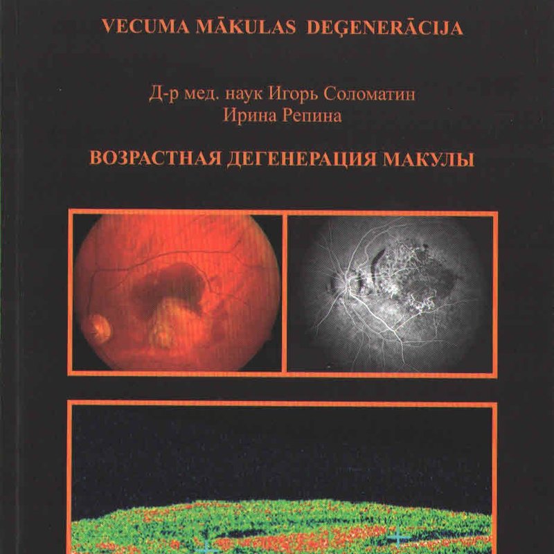 Возрастная  дегенерация макулы