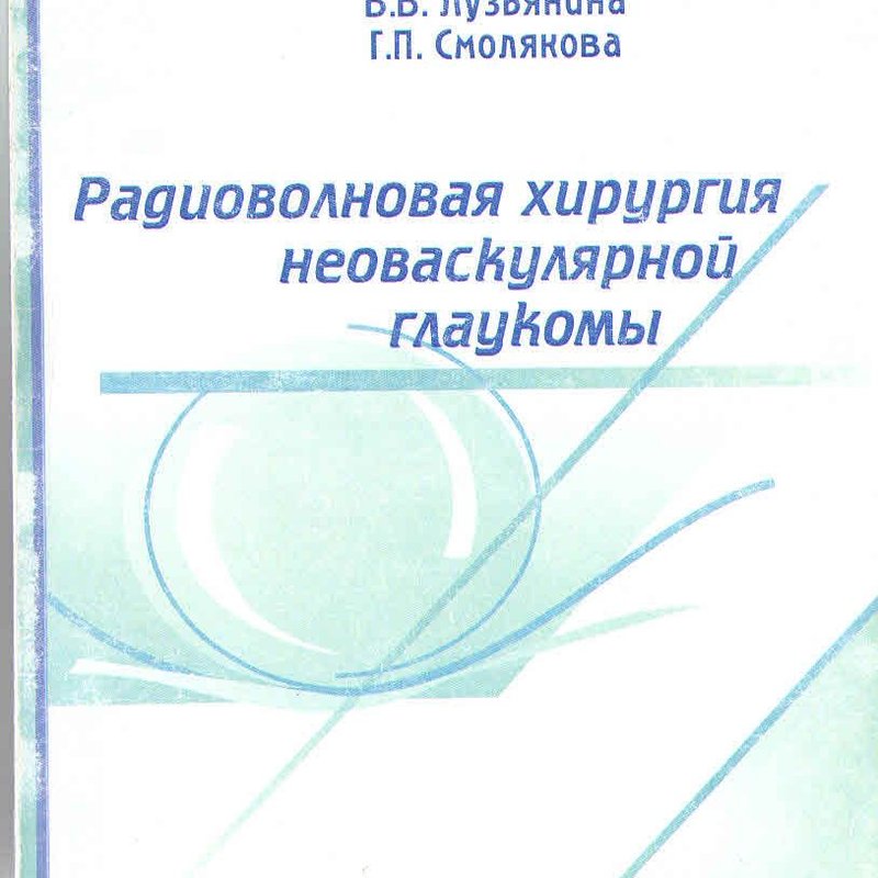 Радиоволновая хирургия неоваскулярной глаукомы