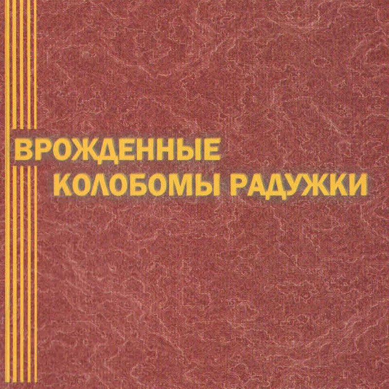 Врожденные колобомы радужки