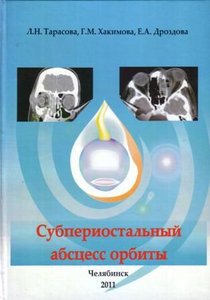 Субпериостальный абсцесс орбиты