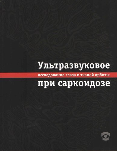Ультразвуковое исследование глаза и тканей орбиты при саркоидозе