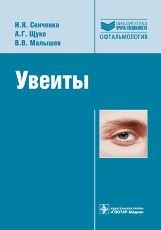 Увеиты