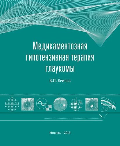 Медикаментозная гипотензивная терапия глаукомы