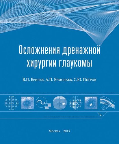 Осложнения дренажной хирургии глаукомы