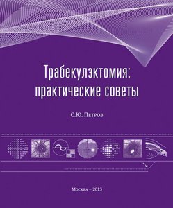 Трабекулэктомия: практические советы