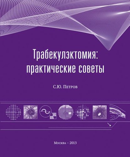 Трабекулэктомия: практические советы