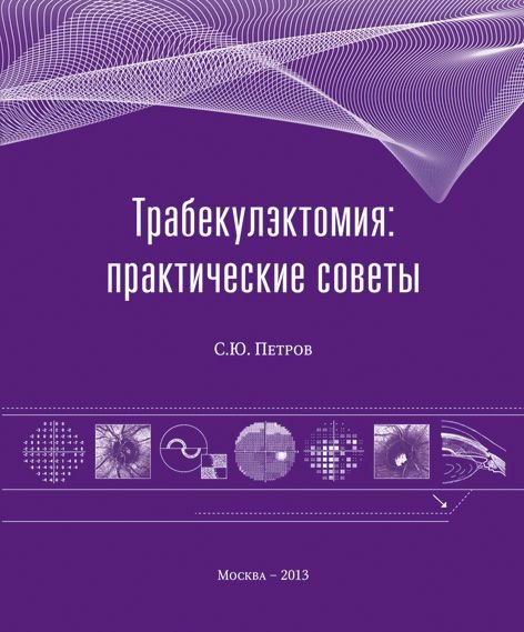 Трабекулэктомия: практические советы