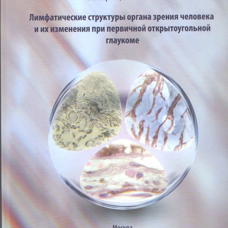 Лимфатические структуры органа зрения человека и их изменения при первичной открытоугольной глаукоме