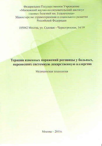 Терапия язвенных поражений роговицы у больных, перенесших системную лекарствееную аллергию.