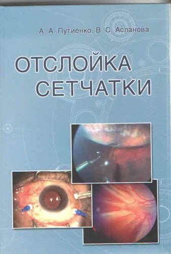 Отслойка сетчатки