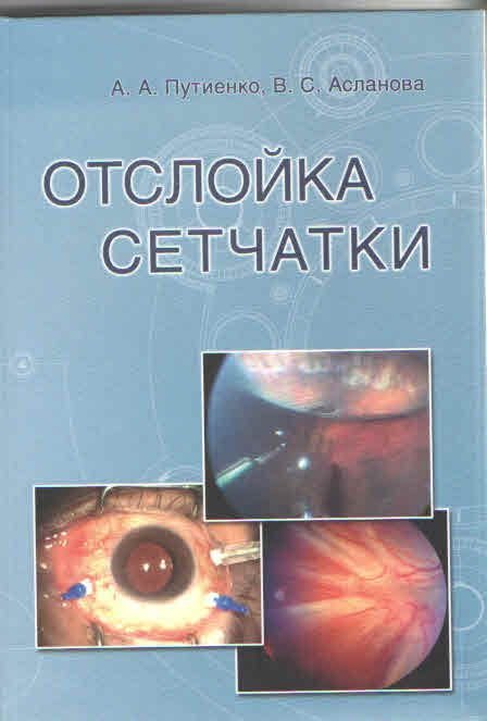 Отслойка сетчатки