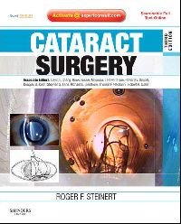 Cataract surgery