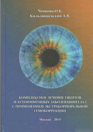 Комплексное лечение увеитов и аутоиммунных заболеваний глаз с применением экстракорпоральной гемокор