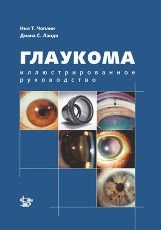 Глаукома. Иллюстрированное руководство