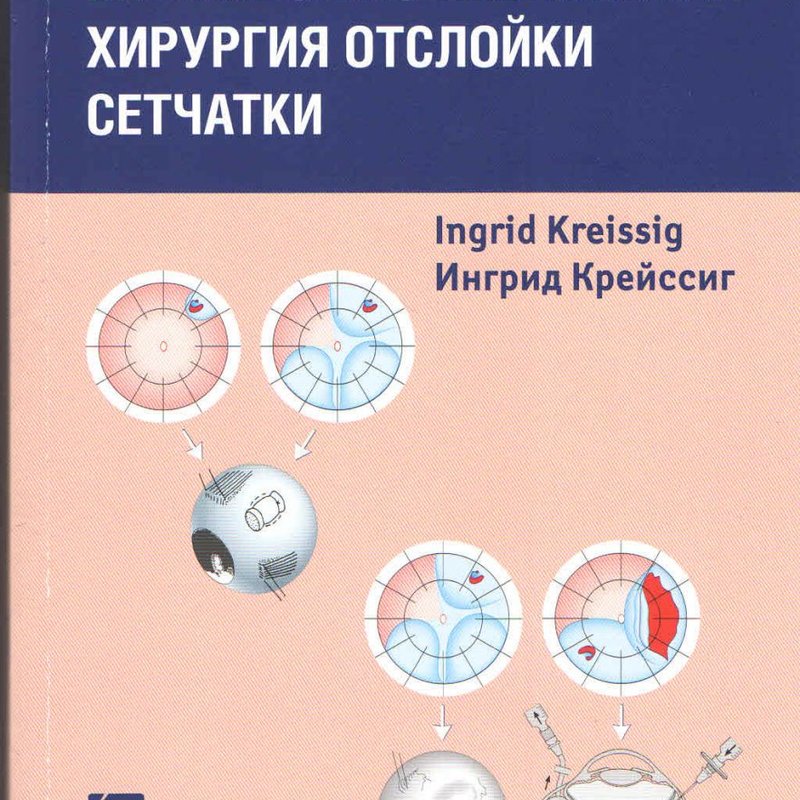 Минимально инвазивная хирургия отслойки сетчатки. Практическое руководство
