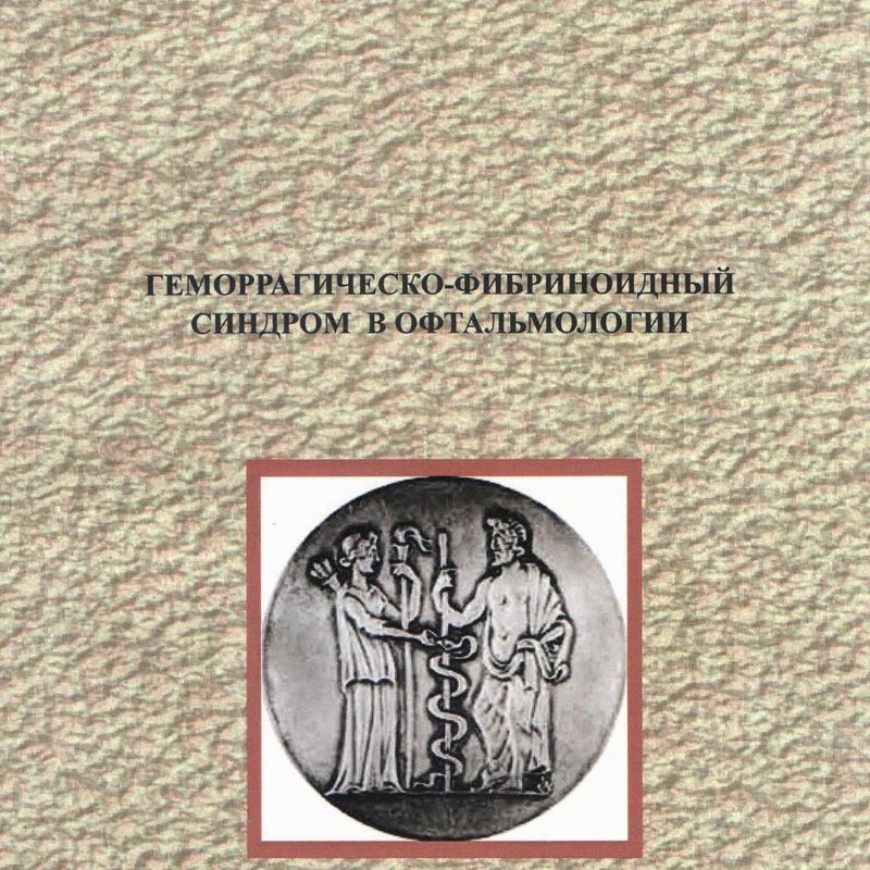 Геморрагическо-фибриноидный синдром в офтальмологии