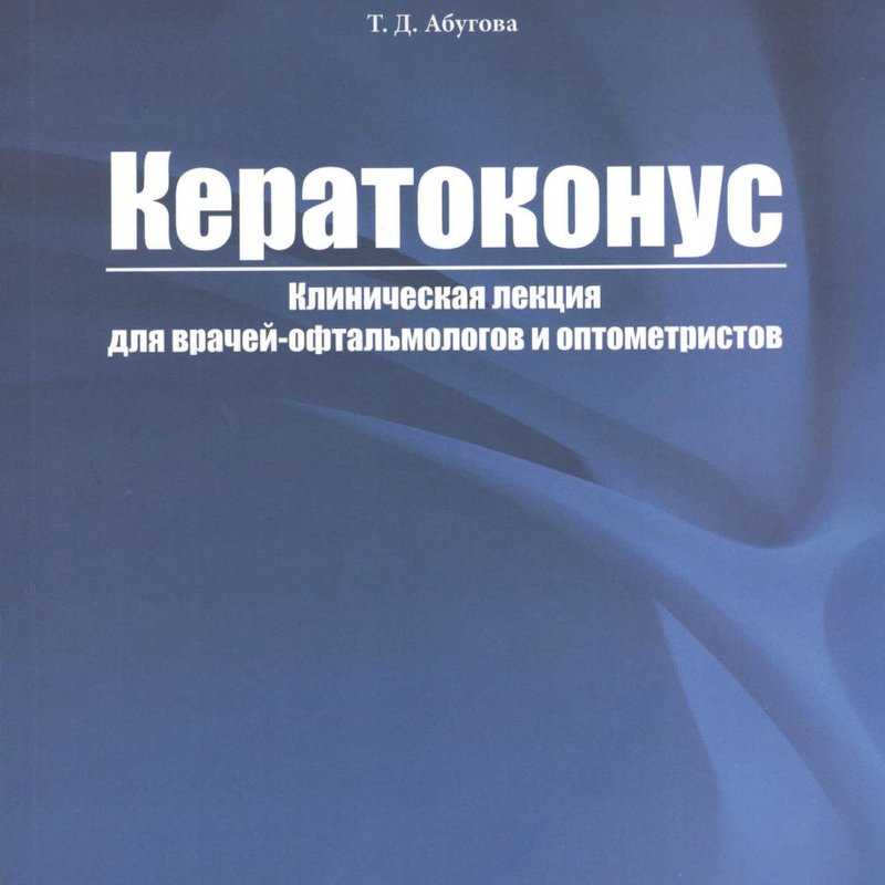 Кератоконус