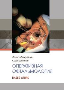 Видео атлас офтальмологических операций
