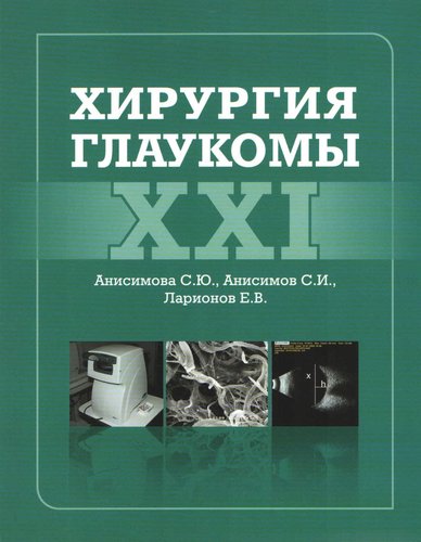 Хирургия глаукомы XXI