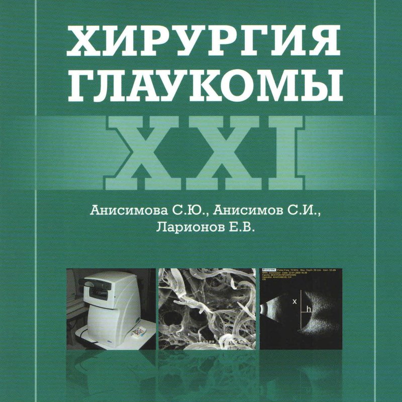 Хирургия глаукомы XXI