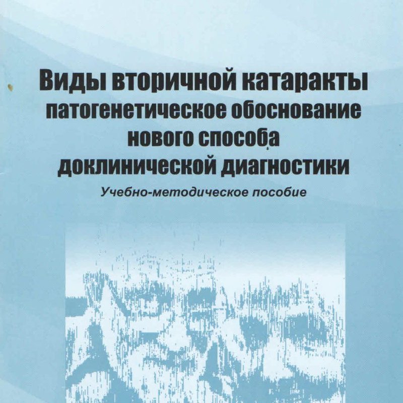 Виды вторичной катаракты патогенетическое обоснование нового способа доклинической диагностики