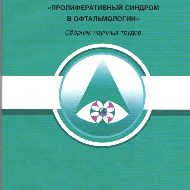 Пролиферативный синдром в офтальмологии