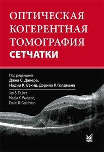 Оптическая когерентная томография сетчатки