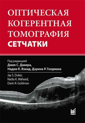 Оптическая когерентная томография сетчатки