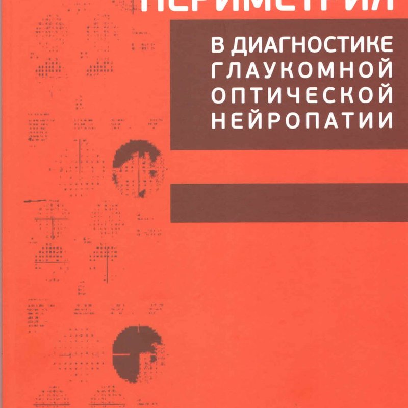 Периметрия в диагностике глаукомной оптической нейропатии