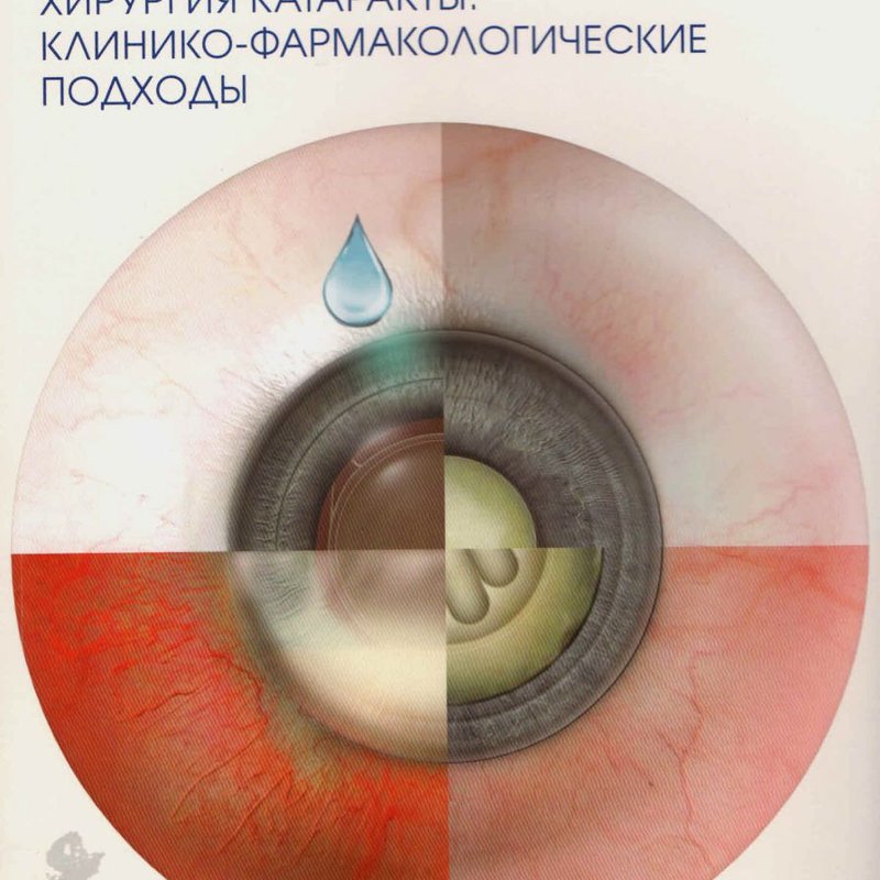Хирургия катаракты: клинико-фармакологические подходы